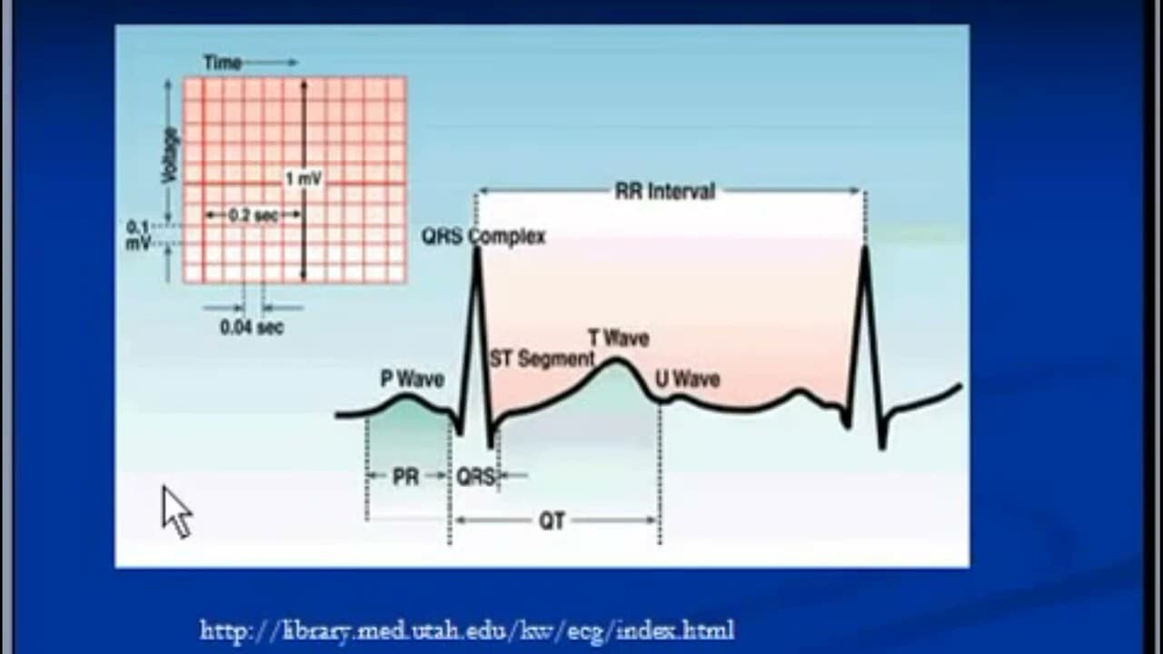 ECG Features of pulmonary Embolism