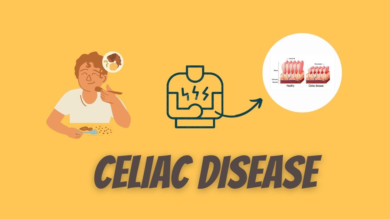 Celiac disease: symptoms, diagnosis and treatment