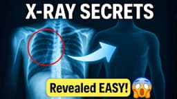 X-ray Physics Secrets Revealed EASY!