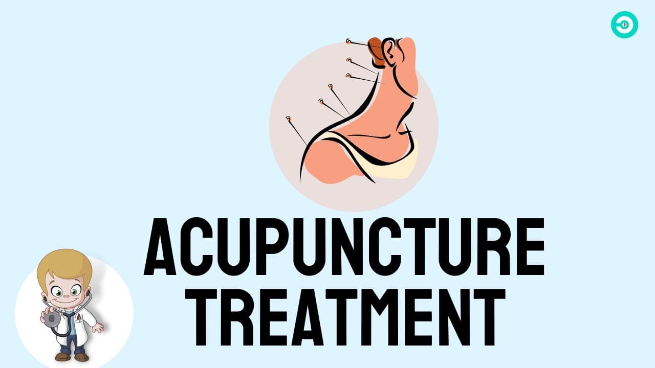 ACUPUNCTURE For Lower Back Pain