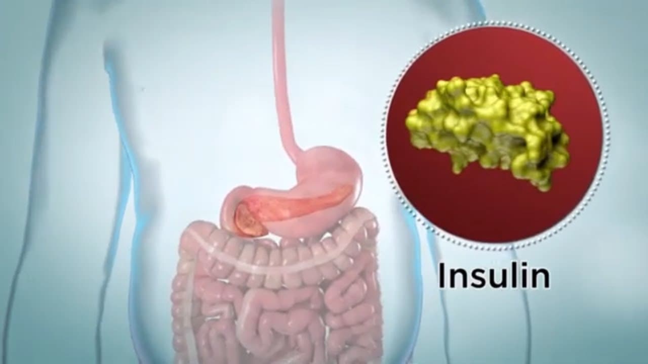 Insulin and Diabetes