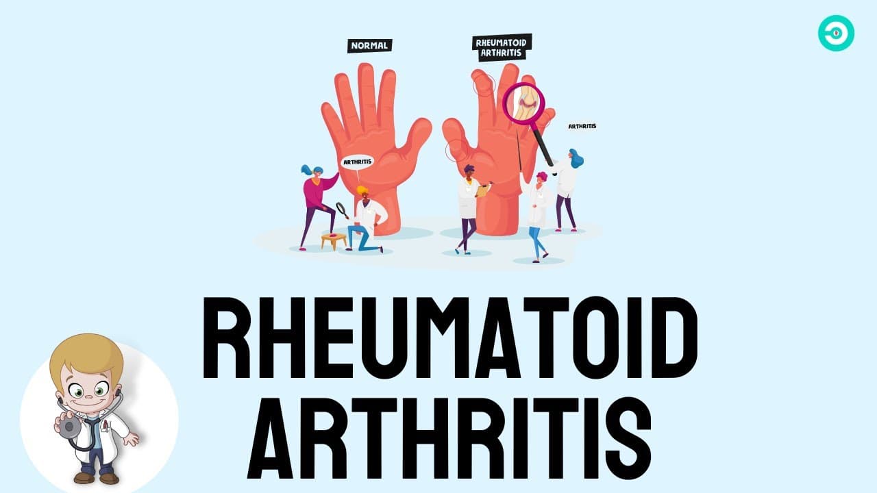 Rheumatoid Arthritis: Causes, symptoms and Treatment options