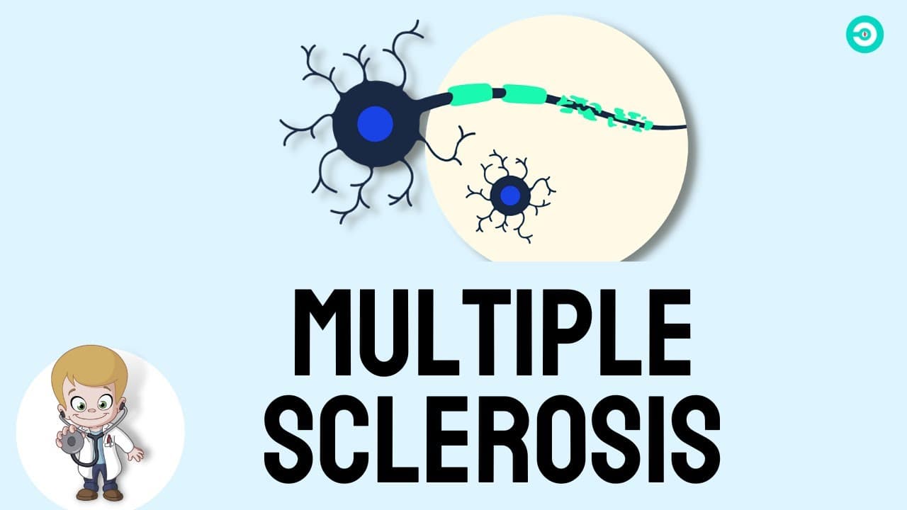 Multiple Sclerosis (MS): Pathophysiology, symptoms, Diagnosis & treatment