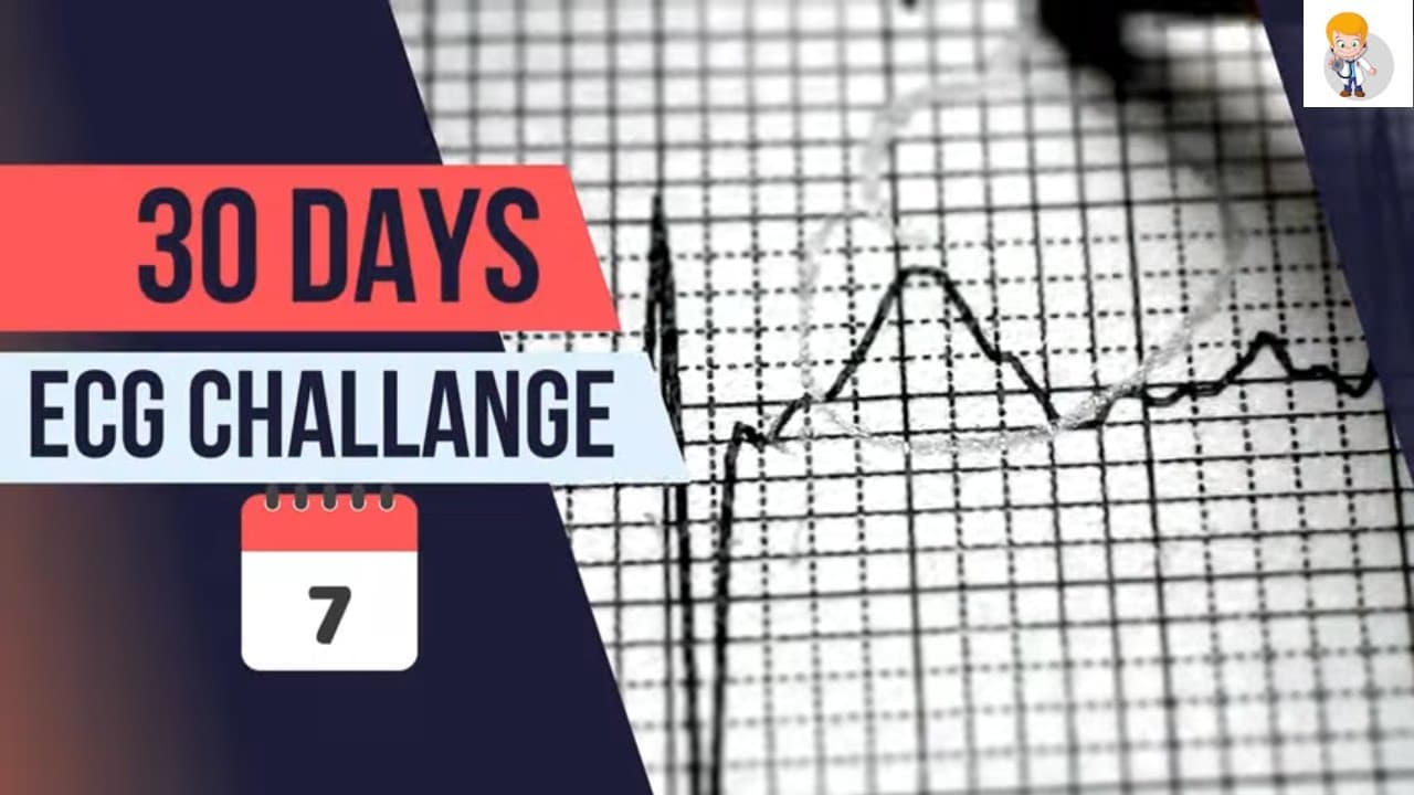 Day 7: Decoding Heart Activity Through ECG | 30-Day ECG Challenge