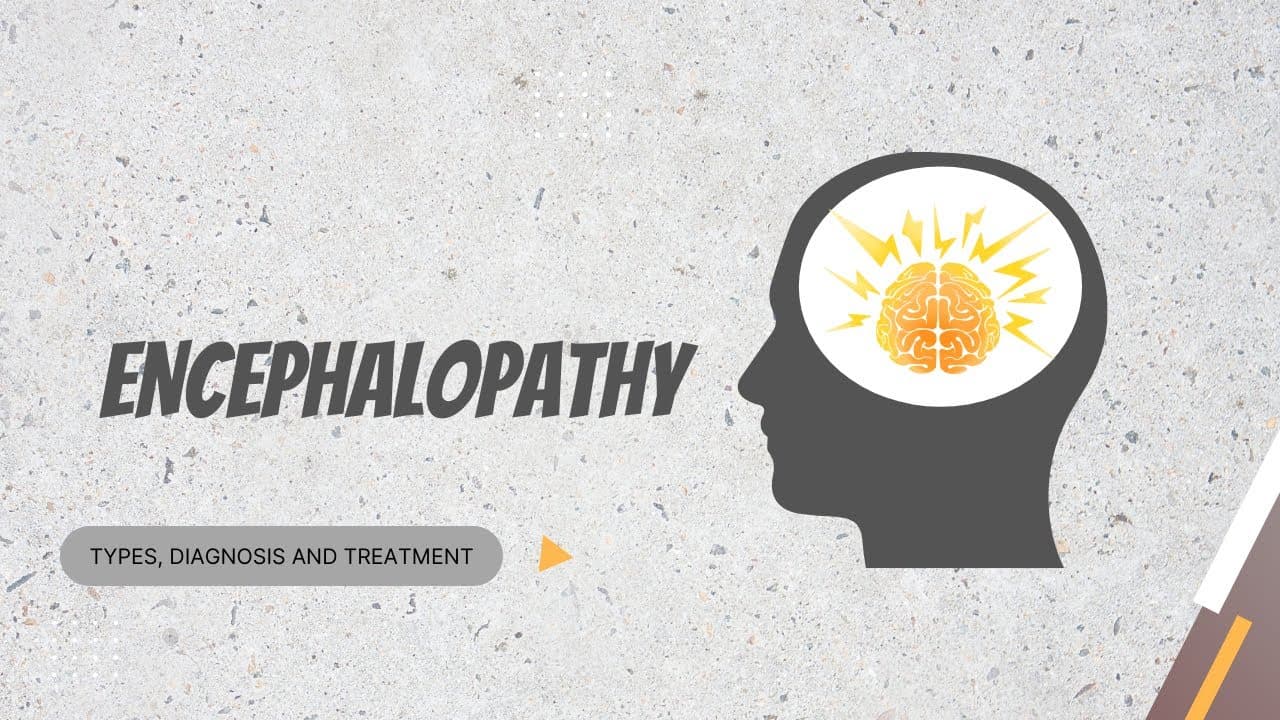 Encephalopathy: types, diagnosis and treatment options