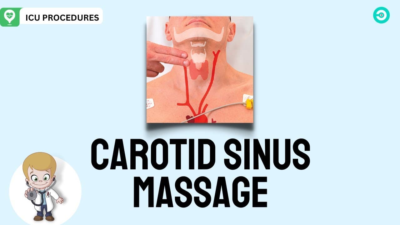 Carotid Sinus Massage: What is it and How to perform the procedure?