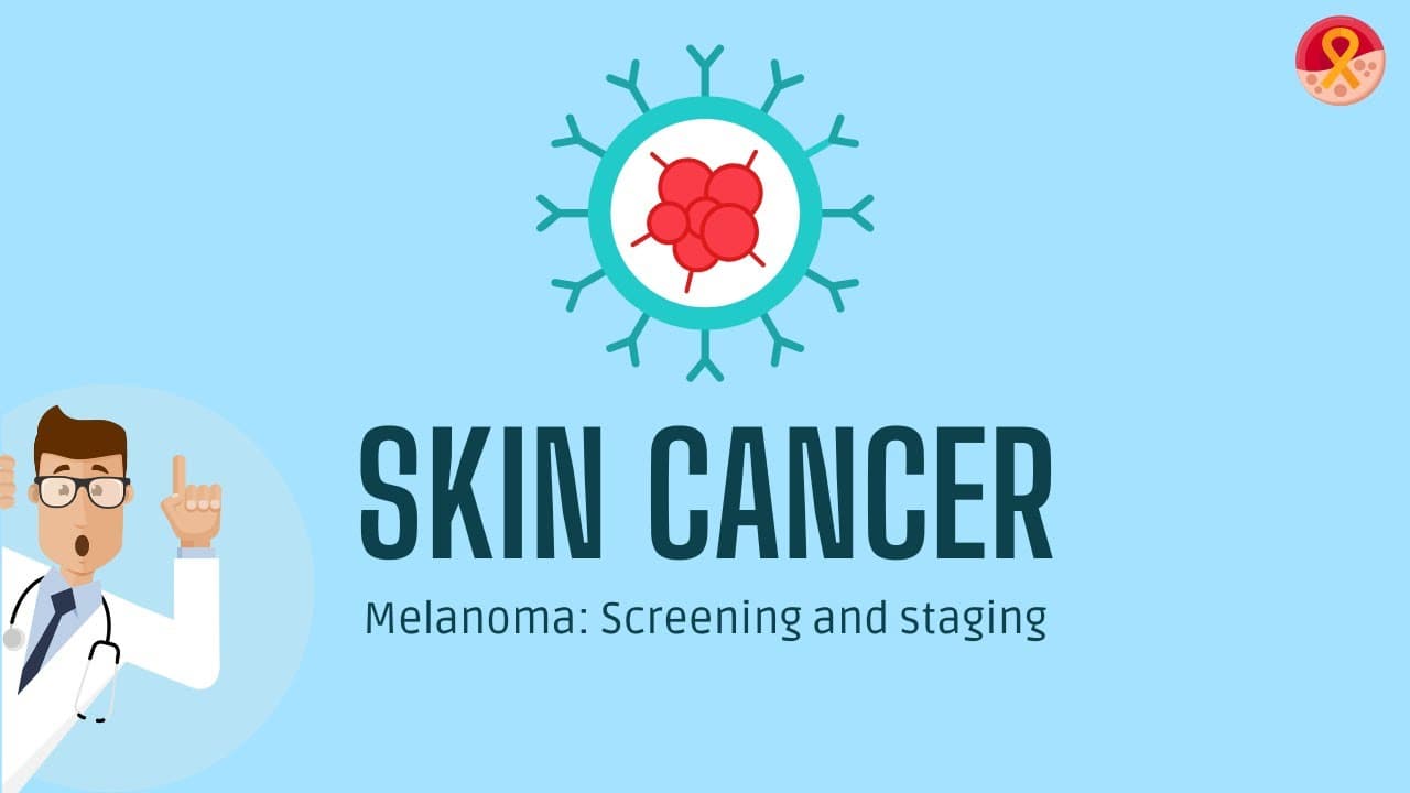 Skin cancer: Screening test and Staging of Melanoma
