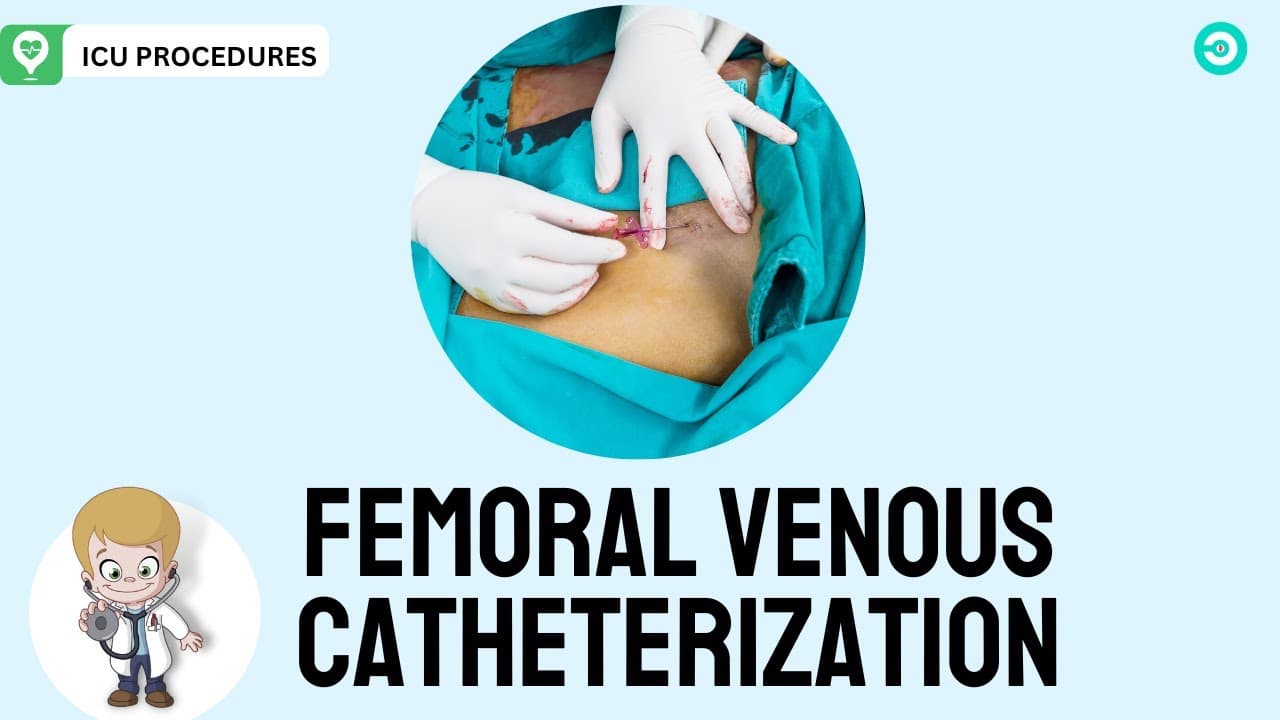 Femoral venous catheterization: step by step procedure