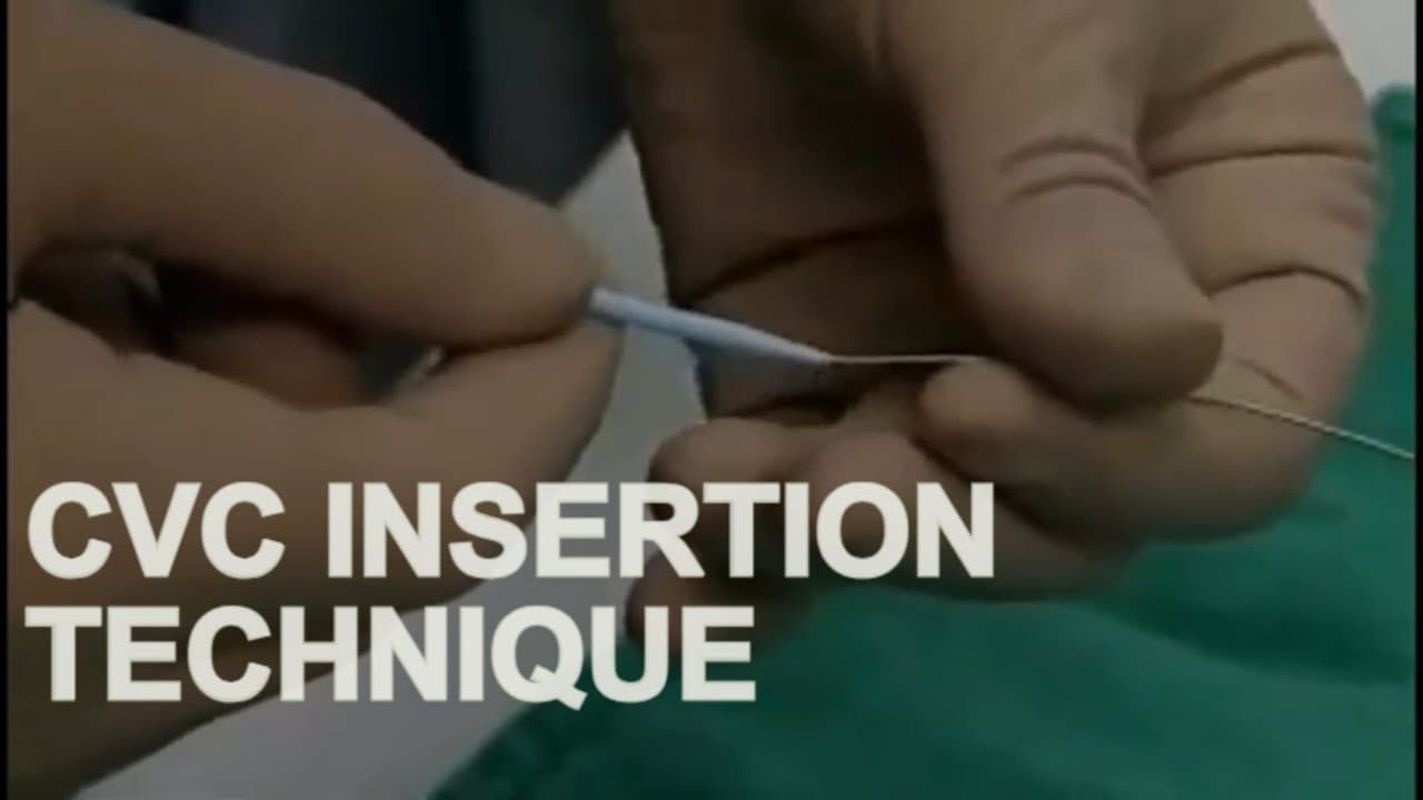 Central Line Training on Mannequin – Educational Guide (step by Step)