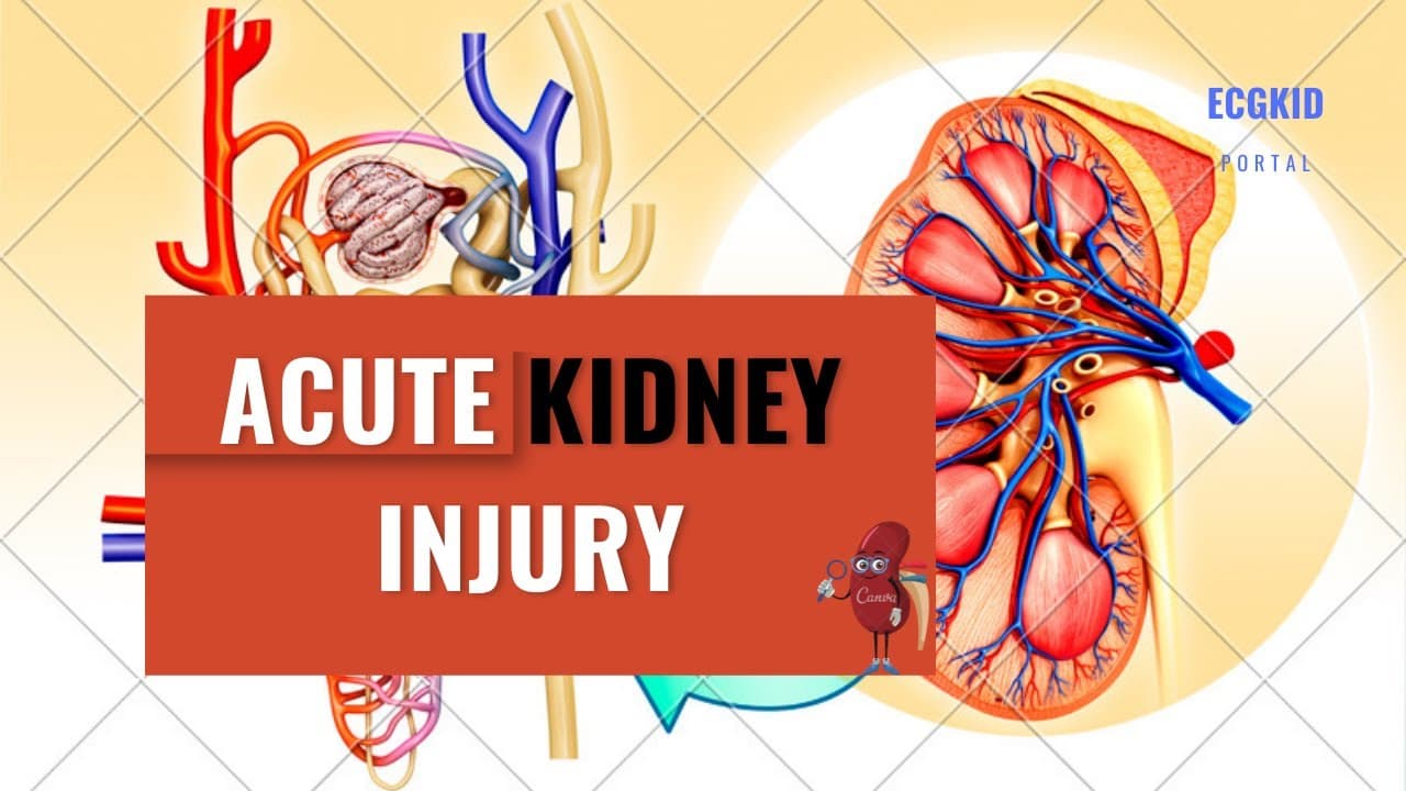 Acute Kidney Injury (AKI): Introduction