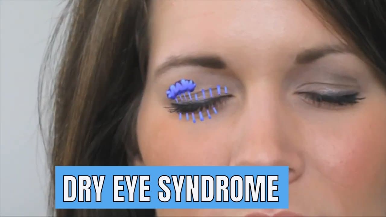 Signs and symptoms of Dry eye syndrome and treatment