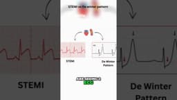 STEMI vs De Winter Pattern ⚡️ | Doctor Explains #medicaleducation #doctorexplains