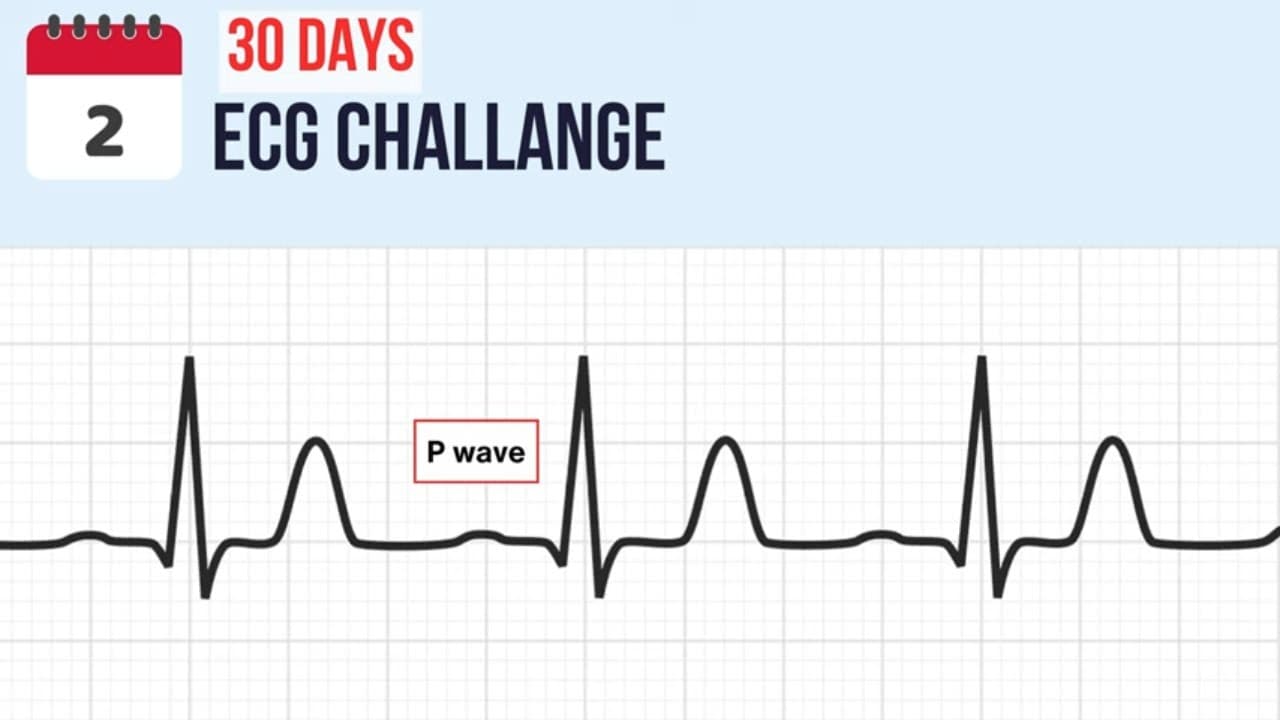 Day 2 - The P Wave on EKG | Join the 30-Day ECG Challenge Now!
