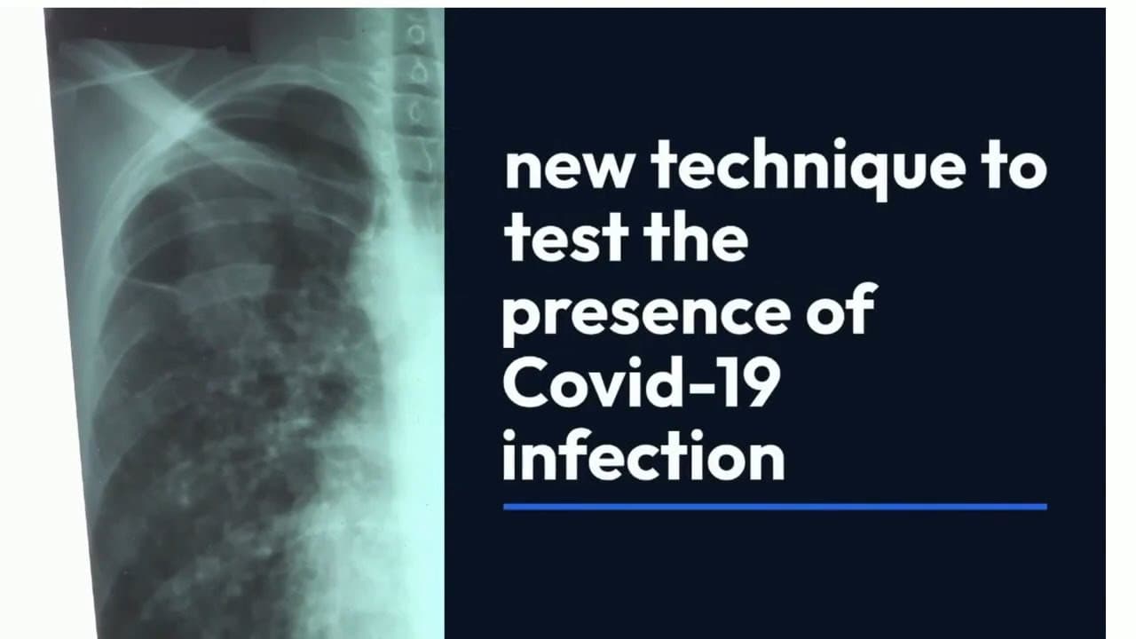 #Latest: Scientists develop #Covid diagnosis test using #X-rays