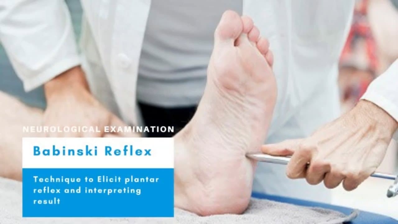 Babinski Sign: Neurological examination