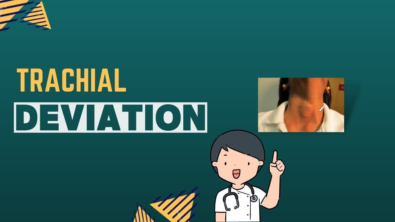 Tracheal Deviation: clinical Examination