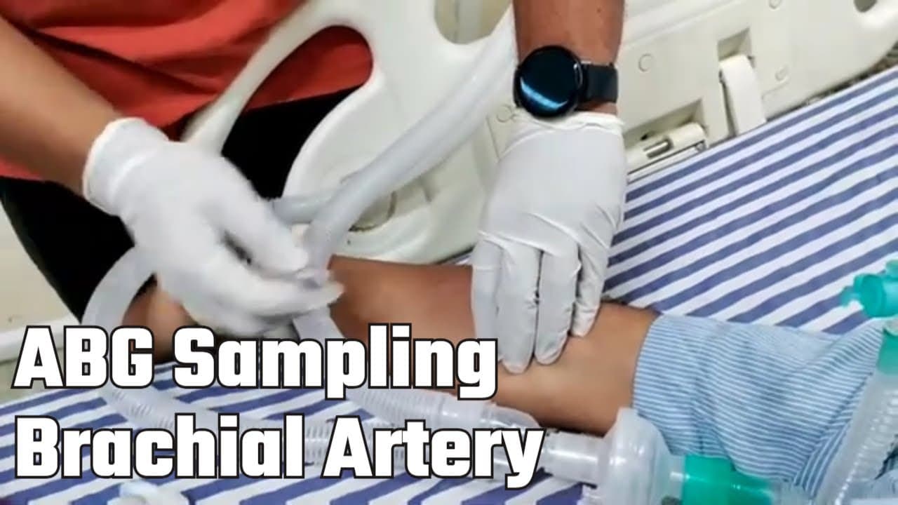Arterial blood gas (ABG) Sampling | Brachial Artery