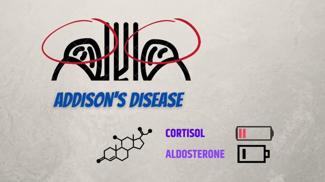 Addison's disease: causes, signs, diagnosis and treatment